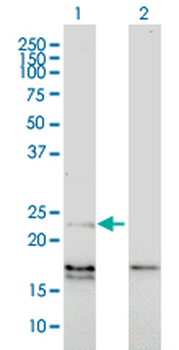 EDN1 monoclonal antibody (M01), clone 3D6