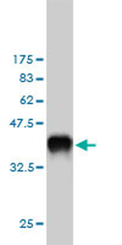 EDN1 monoclonal antibody (M01), clone 3D6