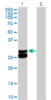 ECHS1 purified MaxPab rabbit polyclonal antibody (D01P)