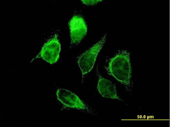 ECHS1 purified MaxPab mouse polyclonal antibody (B01P)