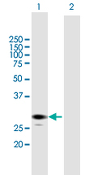 ECHS1 purified MaxPab mouse polyclonal antibody (B01P)