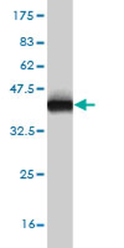 ECH1 monoclonal antibody (M01), clone 5G8