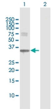 ECH1 MaxPab rabbit polyclonal antibody (D01)