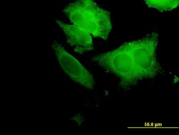 ECH1 purified MaxPab mouse polyclonal antibody (B01P)