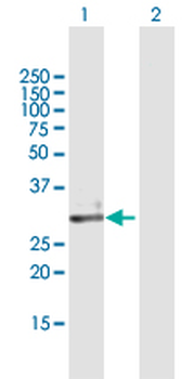 ECH1 purified MaxPab mouse polyclonal antibody (B01P)
