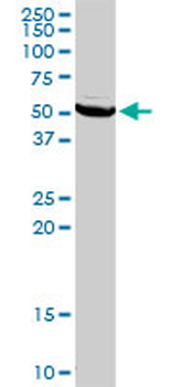 TYMP MaxPab rabbit polyclonal antibody (D01)