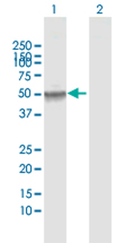 TYMP MaxPab rabbit polyclonal antibody (D01)