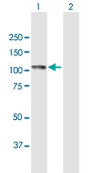 ECE1 purified MaxPab mouse polyclonal antibody (B01P)