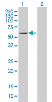 EBF1 monoclonal antibody (M02), clone 1G8