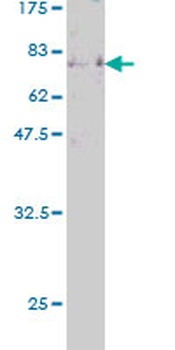 EBF1 monoclonal antibody (M02), clone 1G8