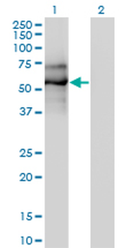 EBF1 monoclonal antibody (M01J), clone 1C12