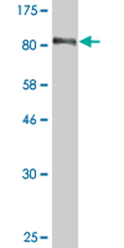 EBF1 monoclonal antibody (M01J), clone 1C12