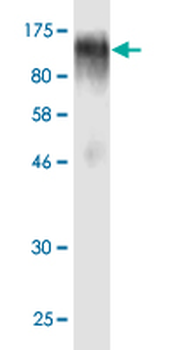 EBF1 monoclonal antibody (M01), clone 1C12