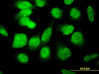 E4F1 monoclonal antibody (M03), clone 4B10