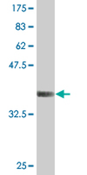E4F1 monoclonal antibody (M03), clone 4B10