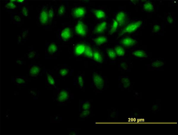 E2F6 monoclonal antibody (M02), clone 1F7-A9