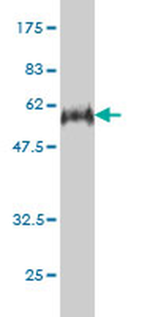 E2F6 monoclonal antibody (M02), clone 1F7-A9