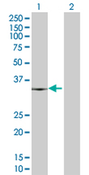 E2F6 MaxPab mouse polyclonal antibody (B01P)