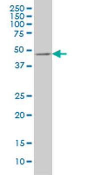E2F3 monoclonal antibody (M01), clone 5F7