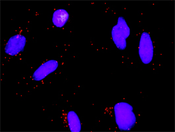 E2F3 monoclonal antibody (M01), clone 5F7