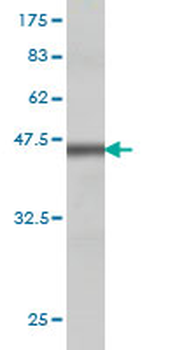 E2F3 monoclonal antibody (M01), clone 5F7