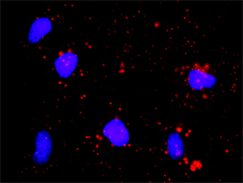 E2F1 monoclonal antibody (M01), clone 2E10