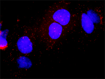 E2F1 monoclonal antibody (M01), clone 2E10