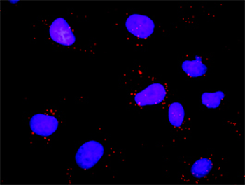 E2F1 monoclonal antibody (M01), clone 2E10