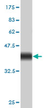 E2F1 monoclonal antibody (M01), clone 2E10