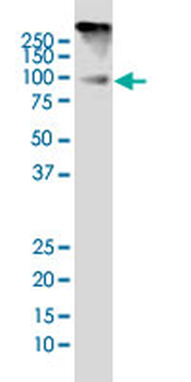 DYRK1A monoclonal antibody (M01), clone 7D10