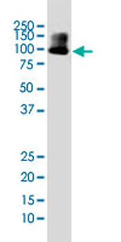 DYRK1A monoclonal antibody (M01), clone 7D10