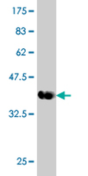 DYRK1A monoclonal antibody (M01), clone 7D10