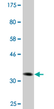 DVL3 monoclonal antibody (M04A), clone 4H2
