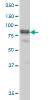 DVL3 monoclonal antibody (M04), clone 4H2