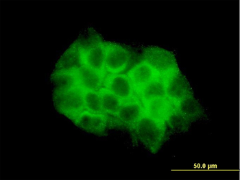 DVL3 monoclonal antibody (M04), clone 4H2