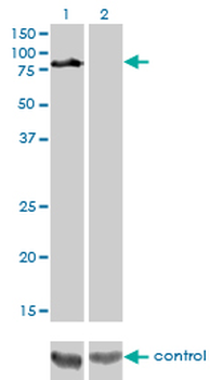 DVL3 monoclonal antibody (M04), clone 4H2