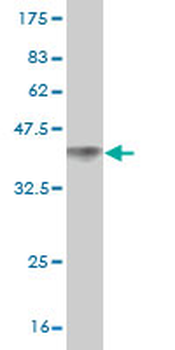 DVL3 monoclonal antibody (M04), clone 4H2