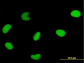 DUT monoclonal antibody (M01), clone 1C9