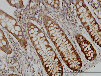 DUT monoclonal antibody (M01), clone 1C9
