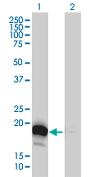 DUT monoclonal antibody (M01), clone 1C9