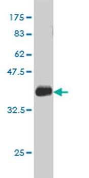DUT monoclonal antibody (M01), clone 1C9