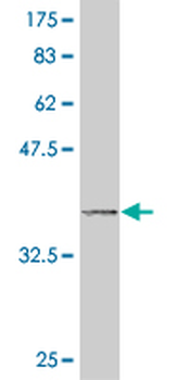 DUSP9 monoclonal antibody (M04), clone 2E3