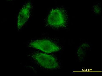 DUSP6 monoclonal antibody (M01), clone 3G2