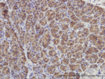 DUSP6 monoclonal antibody (M01), clone 3G2