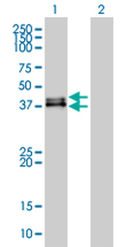 DUSP6 monoclonal antibody (M01), clone 3G2
