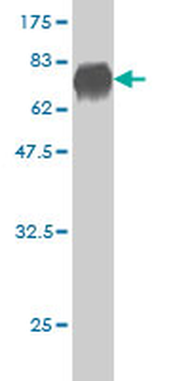 DUSP6 monoclonal antibody (M01), clone 3G2