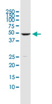 DUSP5 monoclonal antibody (M04), clone 2F3