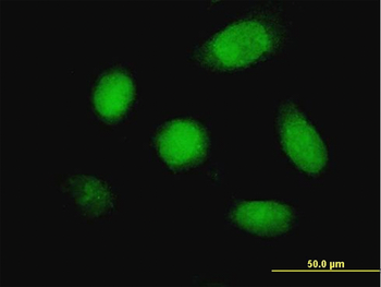 DUSP5 monoclonal antibody (M04), clone 2F3