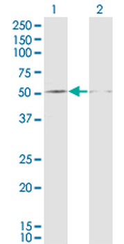 DUSP5 monoclonal antibody (M04), clone 2F3