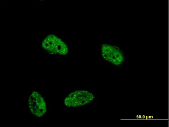 DUSP4 monoclonal antibody (M08), clone 1D12
